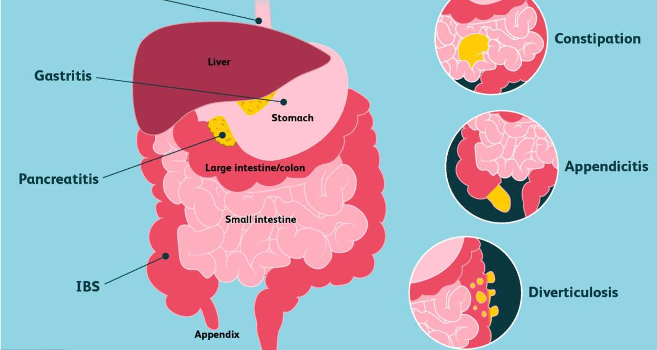 stomach pain Symptoms of lactose intolerance